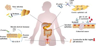 Microbiome in cancer: An exploration of carcinogenesis, immune responses and immunotherapy